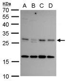 Anti-CITED2 antibody used in Western Blot (WB). GTX129265