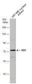 Anti-HDX antibody used in Western Blot (WB). GTX129269