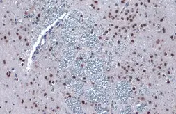 Anti-PERK antibody used in IHC (Paraffin sections) (IHC-P). GTX129275