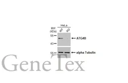 Anti-ATG4B antibody used in Western Blot (WB). GTX129276