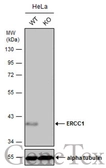 Anti-ERCC1 antibody used in Western Blot (WB). GTX129282