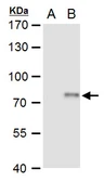 Anti-XPD antibody used in Western Blot (WB). GTX129284