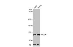 Anti-XPF antibody used in Western Blot (WB). GTX129285