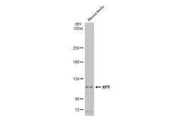 Anti-XPF antibody used in Western Blot (WB). GTX129286
