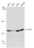 Anti-RFC1 antibody used in Western Blot (WB). GTX129292