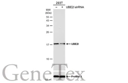 Anti-UBE2I antibody used in Western Blot (WB). GTX129293