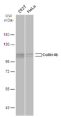 Anti-Cullin 4b antibody used in Western Blot (WB). GTX129297