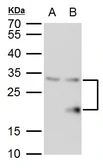 Anti-SMUG1 antibody used in Western Blot (WB). GTX129302
