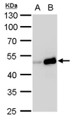 Anti-TIPIN antibody used in Western Blot (WB). GTX129308