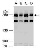 Anti-Claspin antibody used in Western Blot (WB). GTX129311