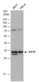 Anti-KLF9 antibody used in Western Blot (WB). GTX129315