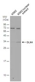 Anti-DLX4 antibody used in Western Blot (WB). GTX129318