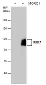 Anti-TORC1 antibody used in Western Blot (WB). GTX129355