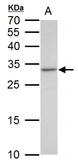 Anti-VENTX antibody used in Western Blot (WB). GTX129357