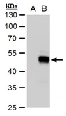 Anti-SOX18 antibody used in Western Blot (WB). GTX129364