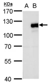 Anti-MKL1 antibody used in Western Blot (WB). GTX129371
