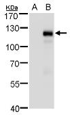 Anti-MKL1 antibody used in Western Blot (WB). GTX129372