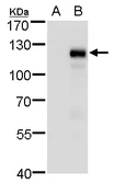 Anti-MKL1 antibody used in Western Blot (WB). GTX129372