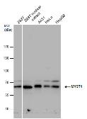 Anti-MYST1 antibody used in Western Blot (WB). GTX129380