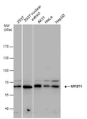 Anti-MYST1 antibody used in Western Blot (WB). GTX129380