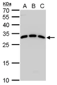 Anti-Spi-C antibody used in Western Blot (WB). GTX129386