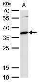 Anti-c-Maf antibody used in Western Blot (WB). GTX129420