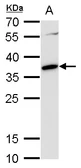 Anti-c-Maf antibody used in Western Blot (WB). GTX129420