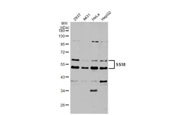 Anti-SS18 antibody used in Western Blot (WB). GTX129428