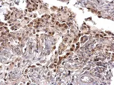 Anti-TRPS1 antibody used in IHC (Paraffin sections) (IHC-P). GTX129429