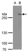 Anti-ARID1A antibody used in Western Blot (WB). GTX129432