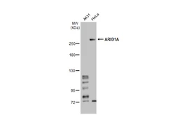 Anti-ARID1A antibody used in Western Blot (WB). GTX129433