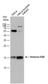 Anti-Histone H2B antibody used in Western Blot (WB). GTX129434