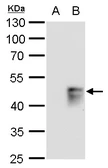 Anti-MAFB antibody used in Western Blot (WB). GTX129437