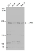 Anti-ARID2 antibody used in Western Blot (WB). GTX129443