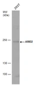 Anti-ARID2 antibody used in Western Blot (WB). GTX129444