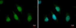 Anti-ARID2 antibody used in Immunocytochemistry/ Immunofluorescence (ICC/IF). GTX129444
