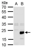 Anti-RGS19 antibody used in Western Blot (WB). GTX129456