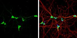 Anti-VIP antibody used in Immunocytochemistry/ Immunofluorescence (ICC/IF). GTX129461