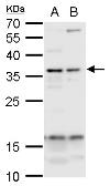 Anti-USF1 antibody used in Western Blot (WB). GTX129467
