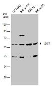 Anti-ZIC1 antibody used in Western Blot (WB). GTX129468