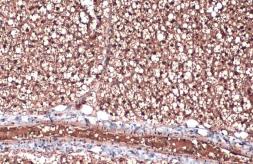 Anti-ZIC1 antibody used in IHC (Paraffin sections) (IHC-P). GTX129468