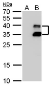 Anti-BarX1 antibody used in Western Blot (WB). GTX129470