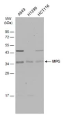 Anti-MPG antibody used in Western Blot (WB). GTX129483