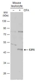 Anti-E2F5 antibody used in Western Blot (WB). GTX129491