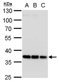 Anti-HOXD13 antibody used in Western Blot (WB). GTX129495