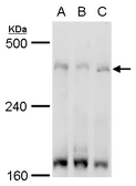 Anti-TRRAP antibody used in Western Blot (WB). GTX129505