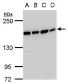 Anti-SMC4 antibody used in Western Blot (WB). GTX129509