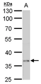 Anti-PTF1A antibody used in Western Blot (WB). GTX129525