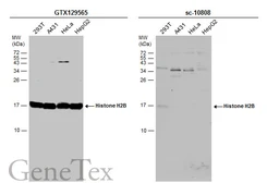 Anti-Histone H2B antibody used in Western Blot (WB). GTX129565