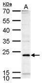 Anti-ICOS antibody used in Western Blot (WB). GTX129570